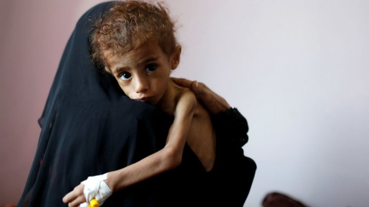 Au Yémen, des enfants meurent parce que l'aide est bloquée, prévient l’Unicef