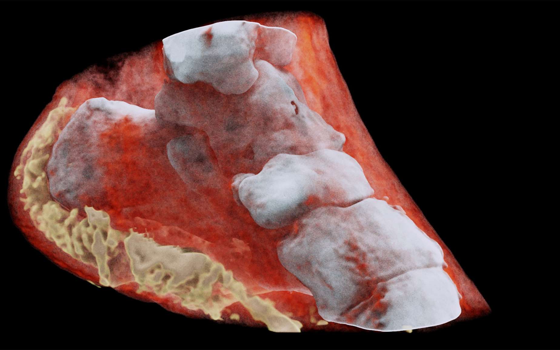 Imagerie médicale : le corps vu par radiographie 3D couleur, une première !