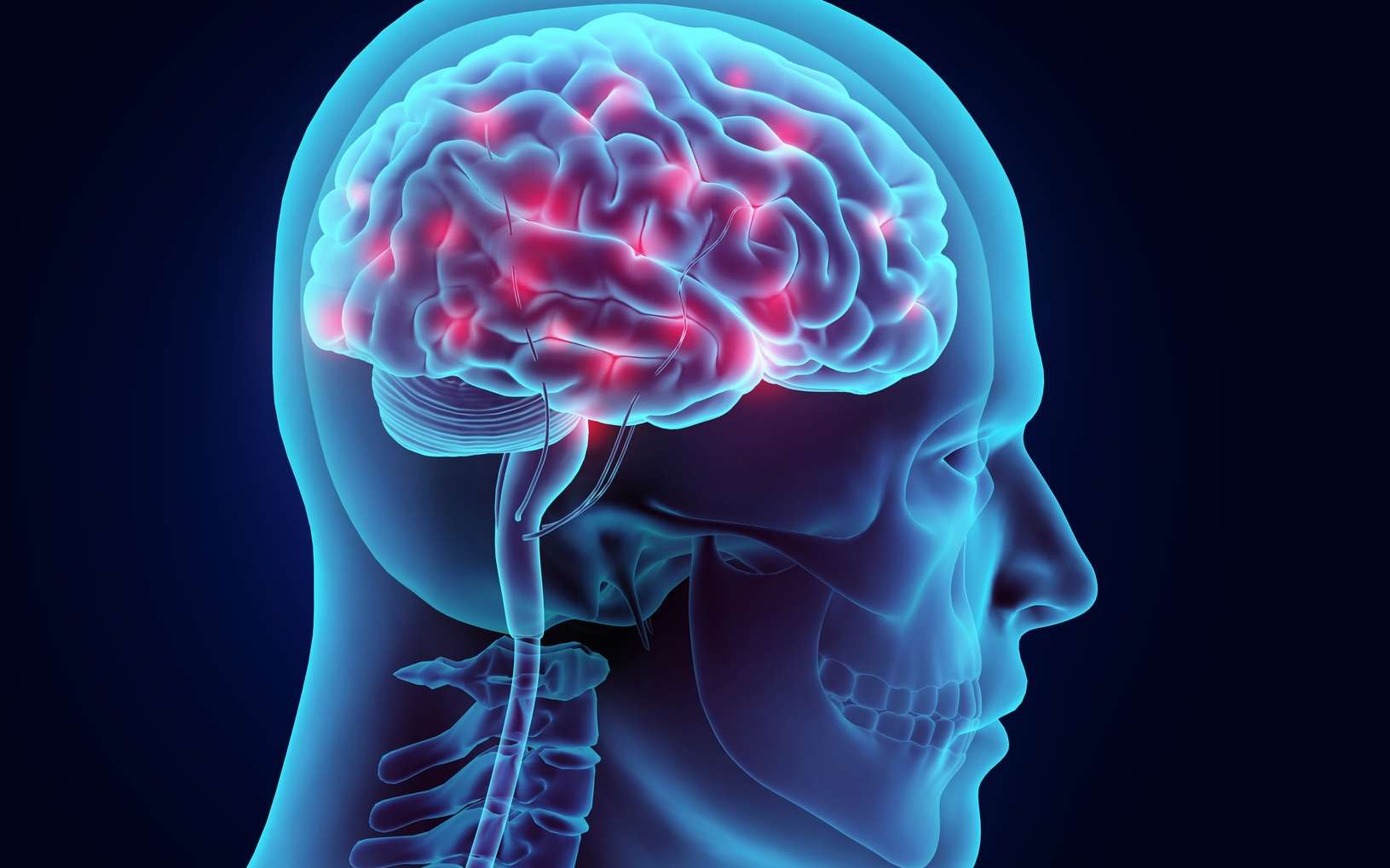 Parkinson : un virus injecté dans le cerveau pour reprogrammer les cellules