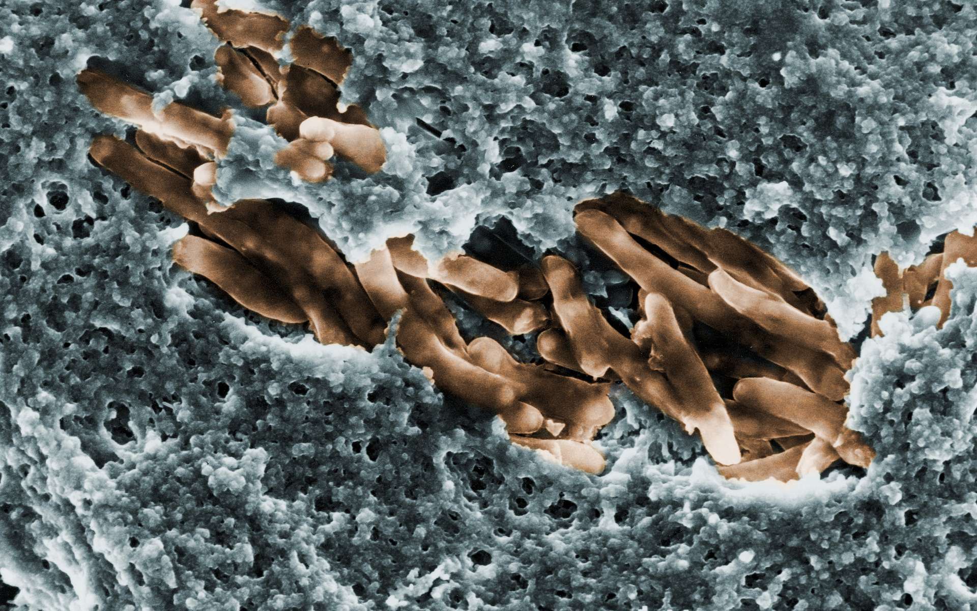 Recrudescence d'une bactérie mangeuse de chair en Australie