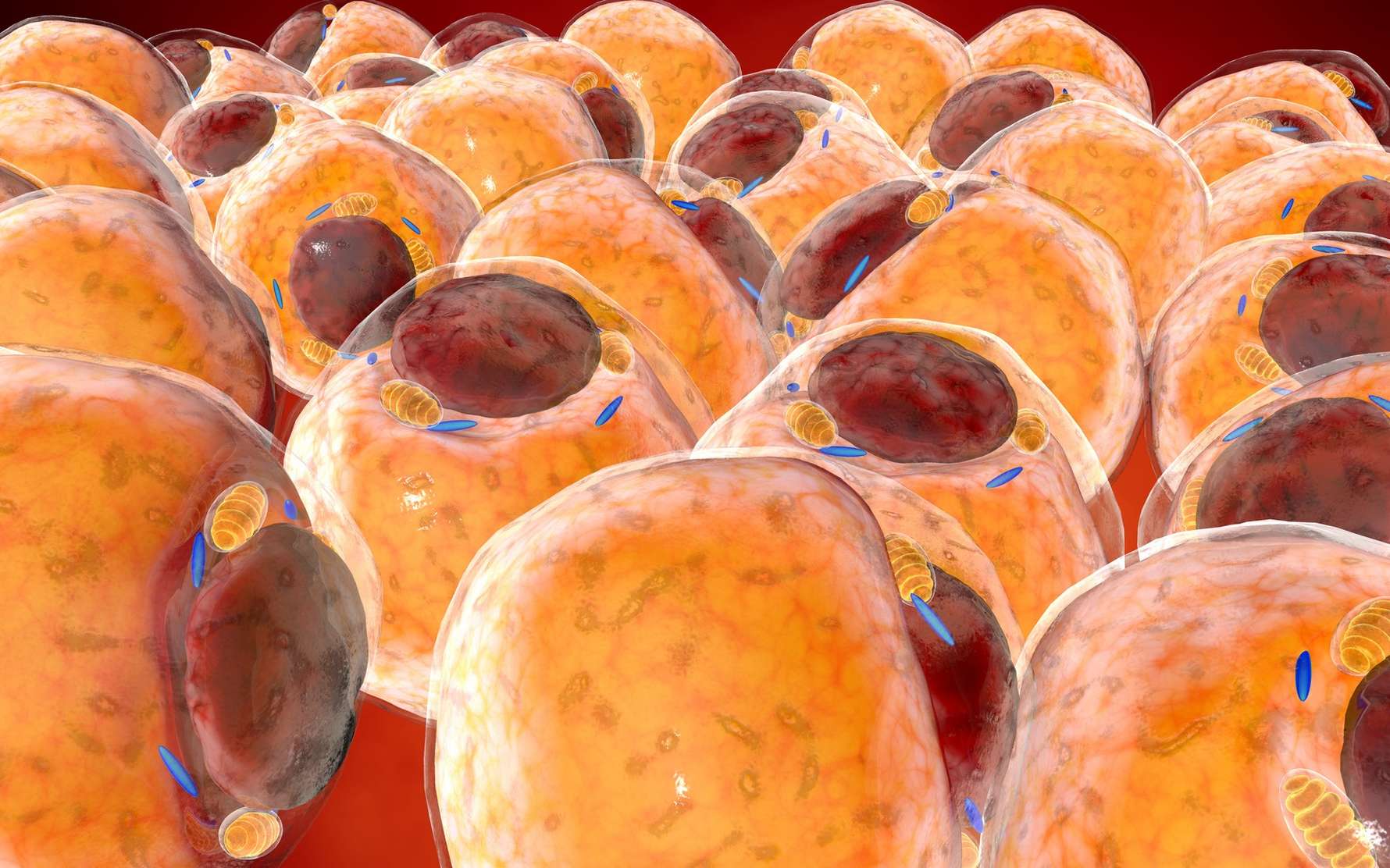 Cancer du sein : les cellules tumorales transformées en graisse