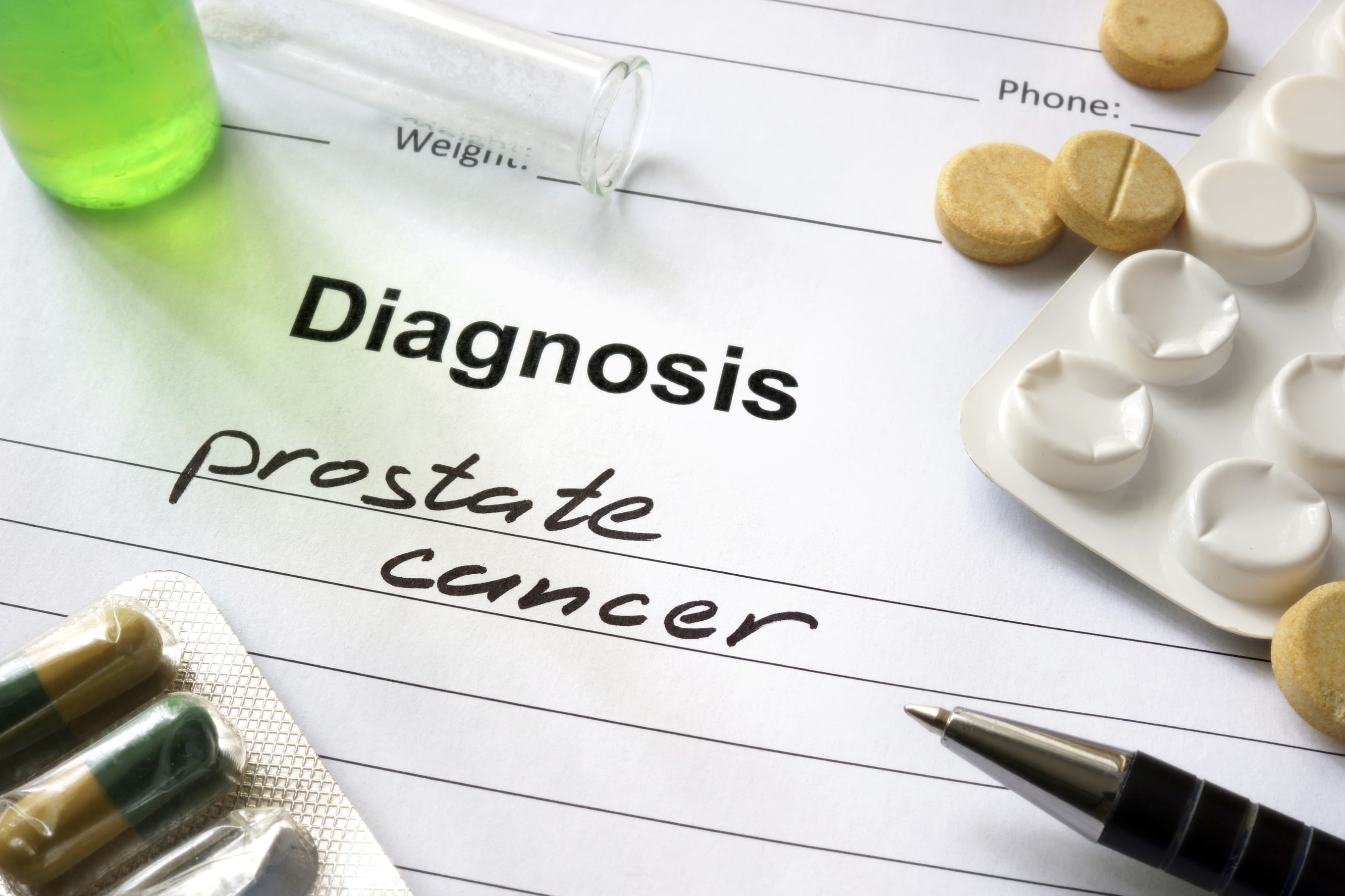 Cancer de la prostate : 99 % de survie avec ou sans traitement