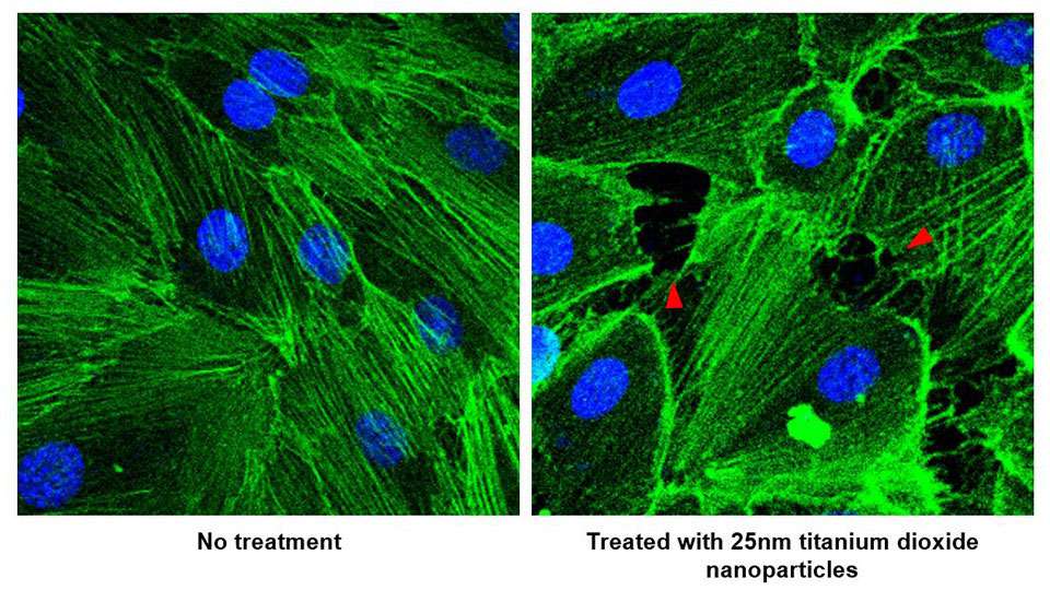 Cancer : les nanoparticules favorisent-elles les métastases ?
