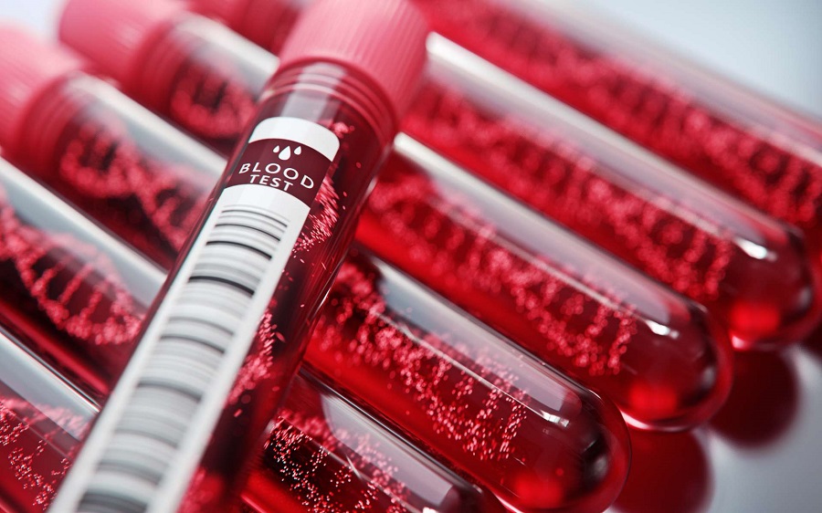 Un test sanguin pour détecter 50 types de cancer