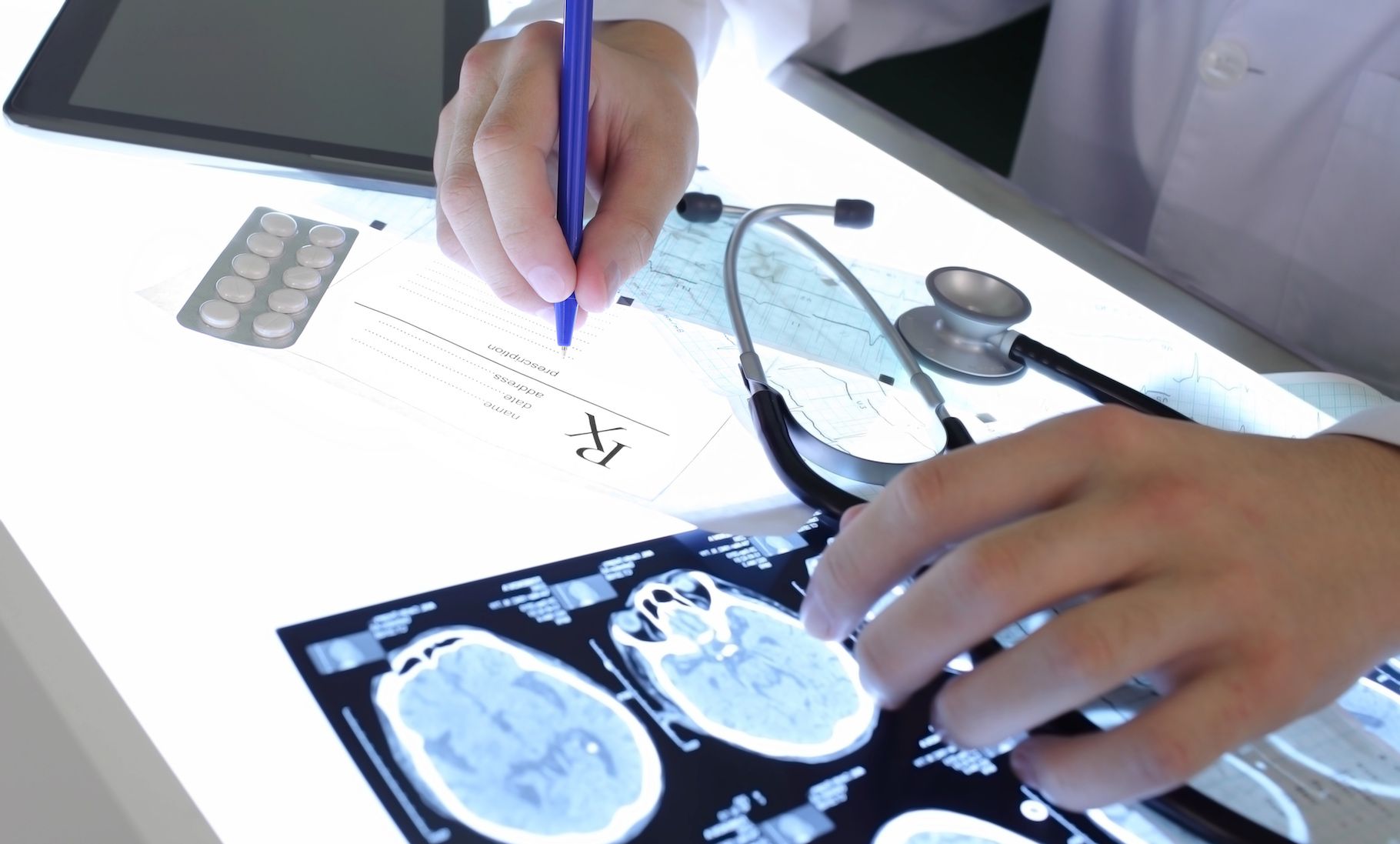 Epilepsie : des promesses d'avancées grâce à un cerveau virtuel