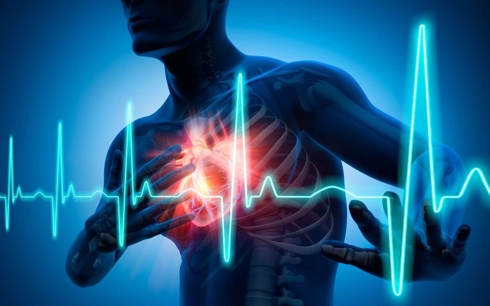 Un patch sur le cœur pour limiter les conséquences d'un infarctus