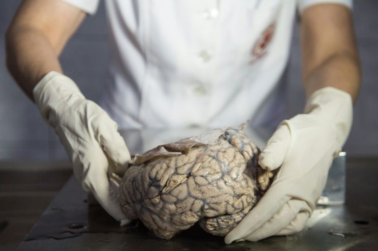 Au Pérou, un musée pour scruter les cerveaux malades