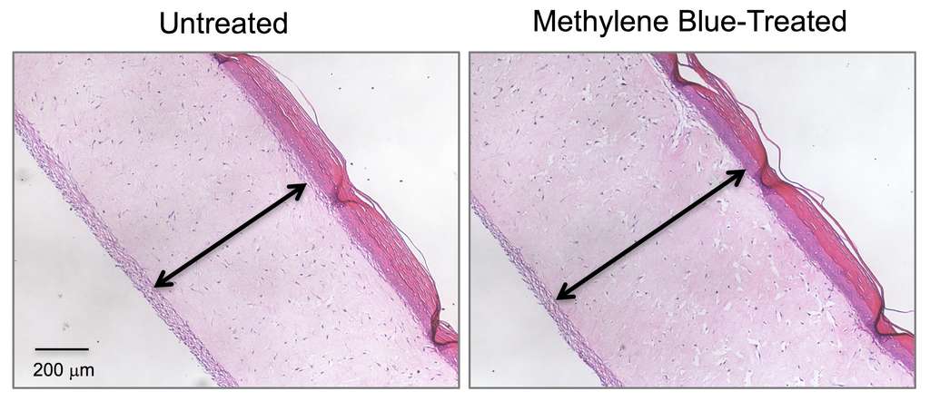 Le bleu de méthylène ralentirait le vieillissement de la peau