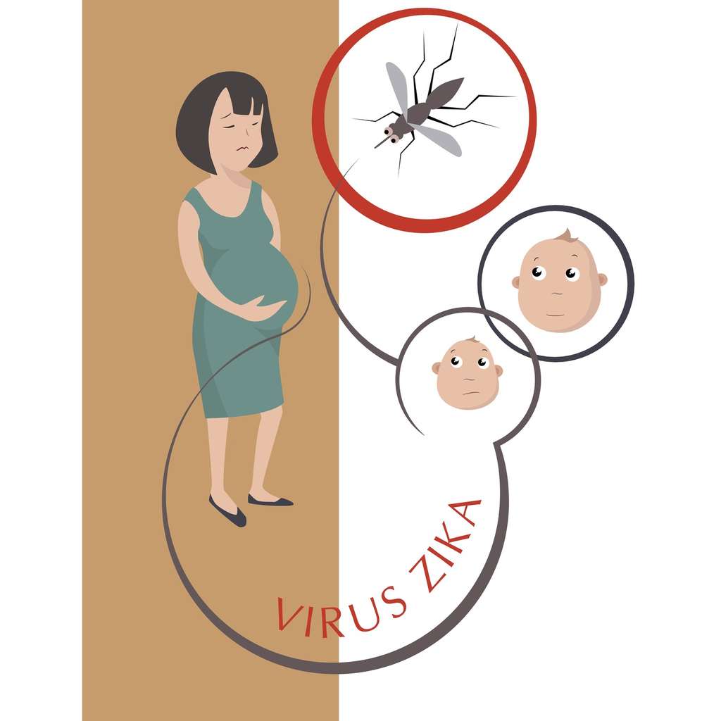 Le virus Zika, une arme contre le cancer du cerveau ?