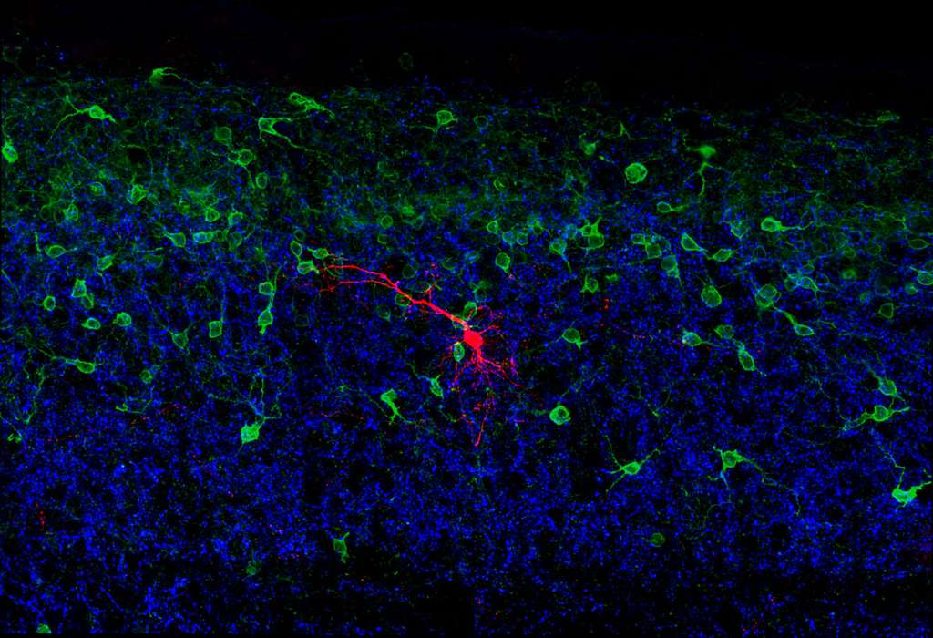 Un « mini-cerveau » pour garder l'équilibre sur la glace