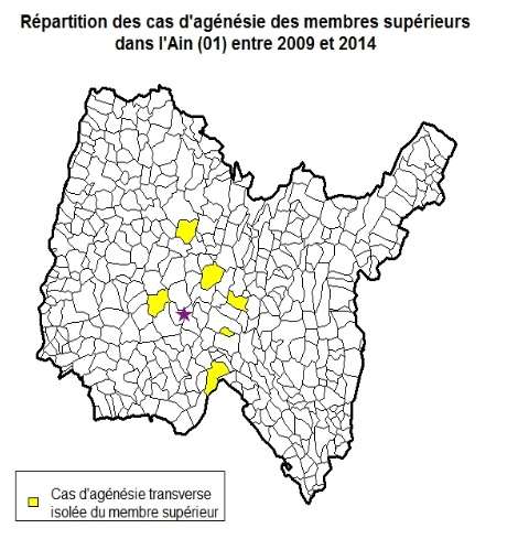 Enfants nés sans main ou bras : des malformations inexpliquées d'après Santé publique France