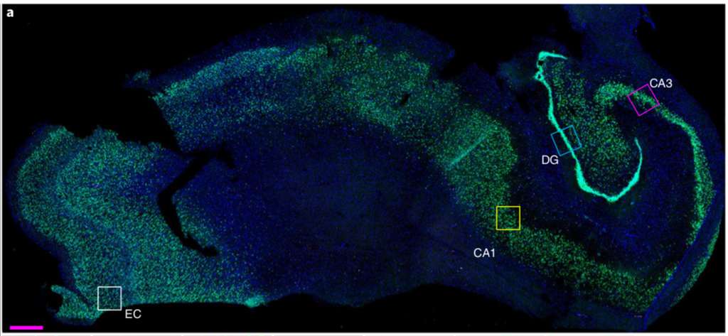 Le cerveau fabrique des nouveaux neurones jusqu'à 90 ans et plus