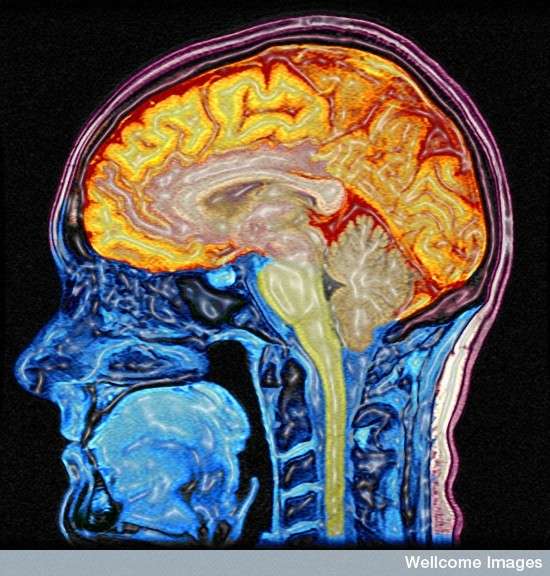 Science décalée : la musique, une langue pour notre cerveau