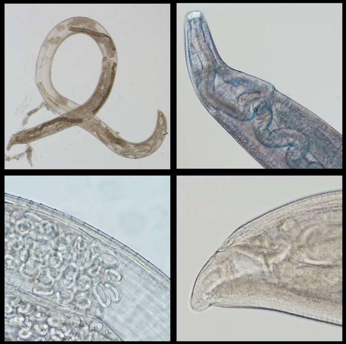 Le ver T.gulosa (en haut à gauche) et les ovaires contenant les œufs que la femelle peut pondre dans l’œil. À droite, les cavités anales et buccales. © Richard S. Bradbury et al., Clinical Infectious Diseases, 2019