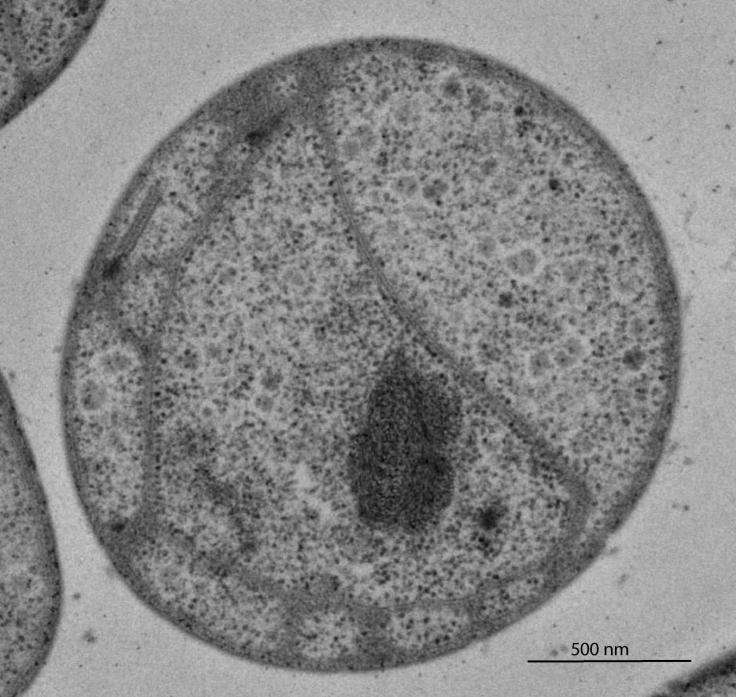 Une photo d'un planctomycète, une bactérie à la physiologie complexe.