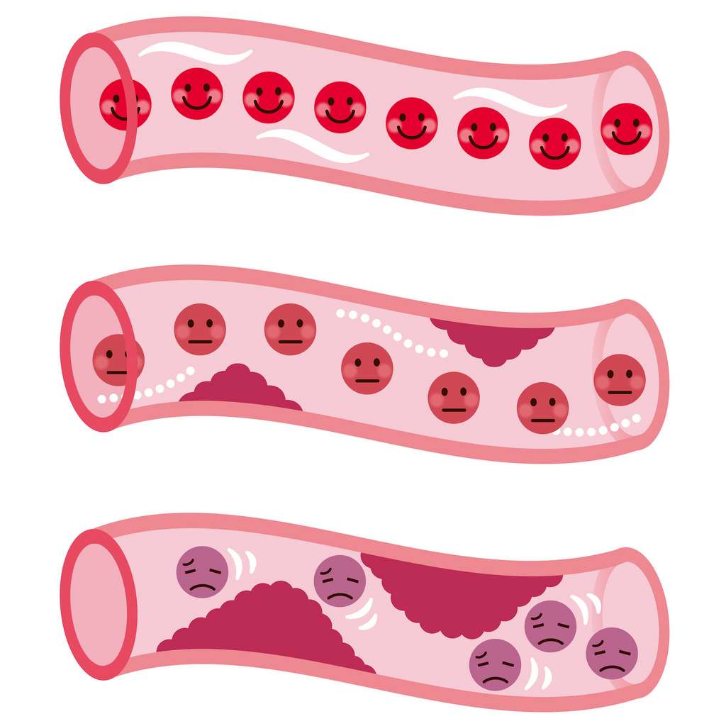 La stase du sang favorise les thromboses veineuses. © koti, Adobe Stock