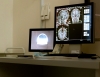 Radiologie : pourquoi l’IA n’a (toujours) pas remplacé le médecin